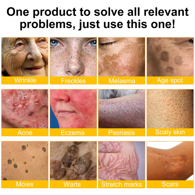 Profitez de -30 % sur le deuxième 🧡